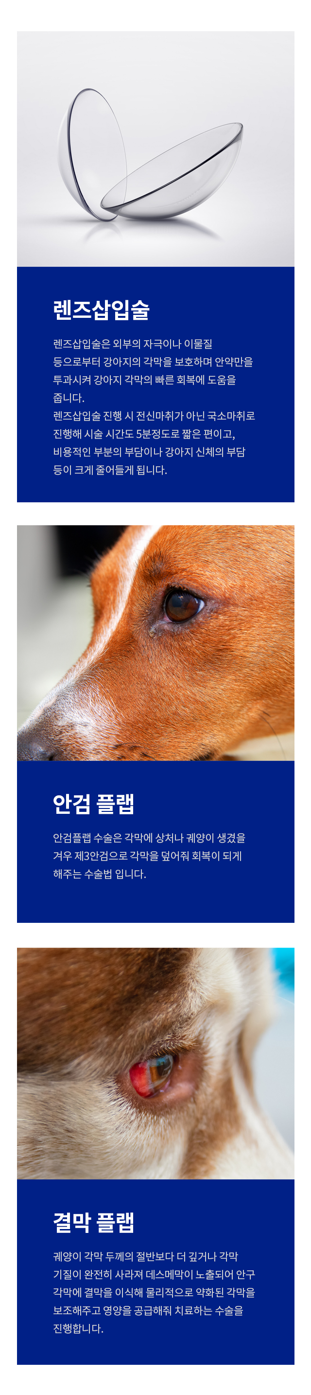 안과